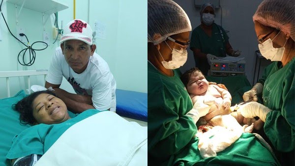 Bebê gigante em Parintins nasceu com 7 quilos — Foto: Divulgação/SES-AM