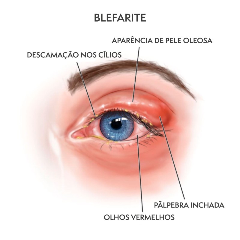 Banco de imagens