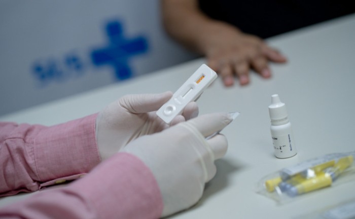 Testes rápidos já estão disponíveis - Foto: Divulgação