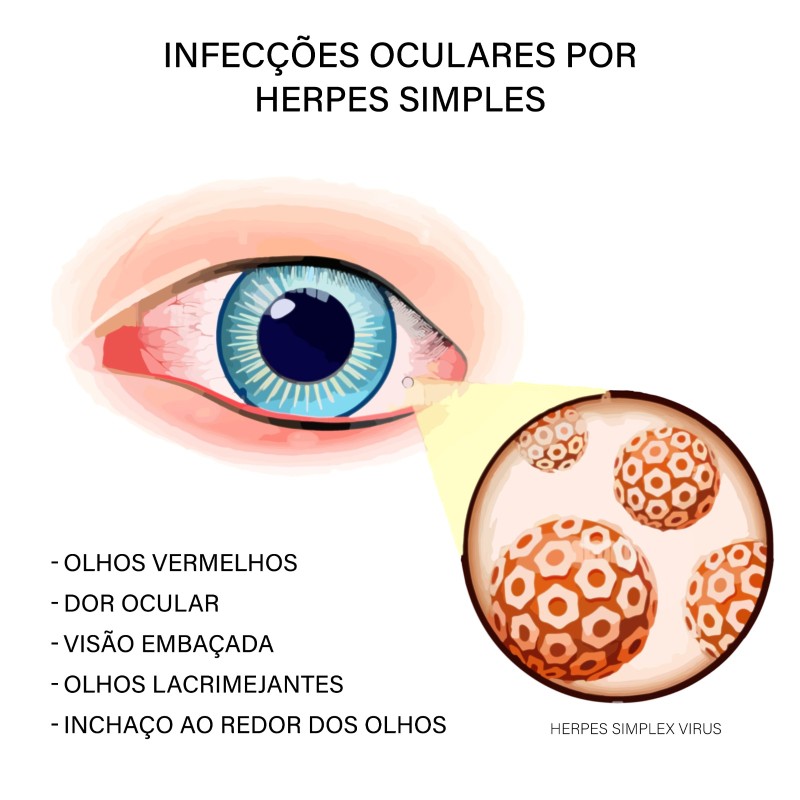 Banco de imagens