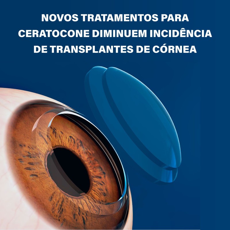 Banco de imagens