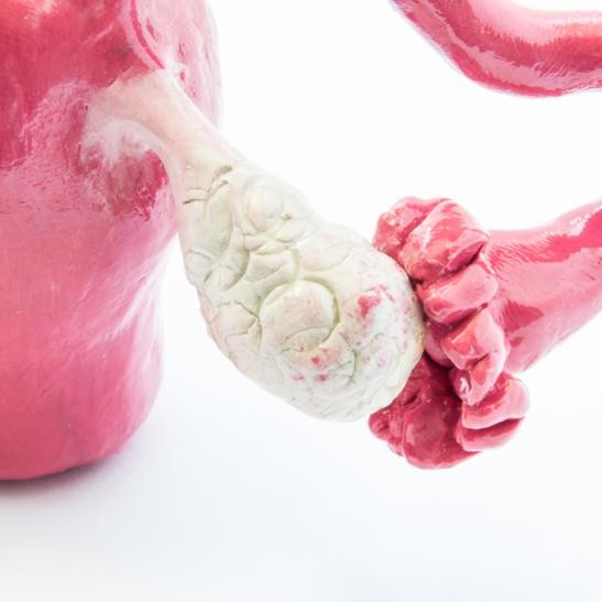 CANVA