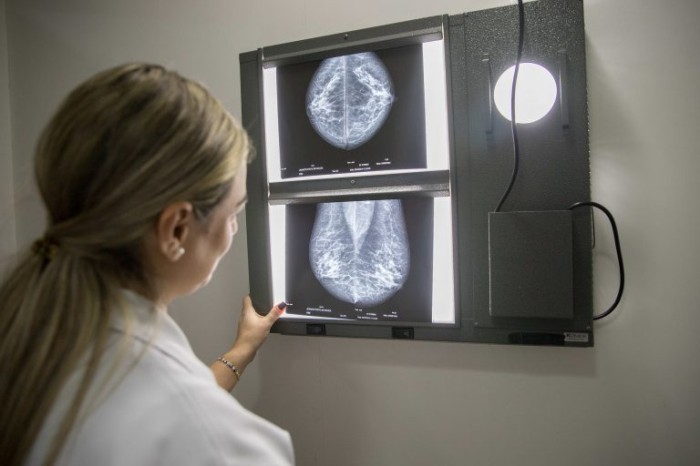 Médica olha uma mamografia; debate abordará importância do diagnóstico precoce - (Foto: Divulgação/Governo de São Paulo)