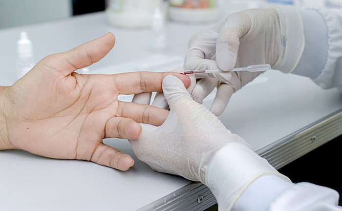 Usuários do SUS fazem teste rápido para diagnóstico das hepatites virais nas Unidades Básicas de Saúde - Foto: Raiza Milhomem/Governo do Tocantins