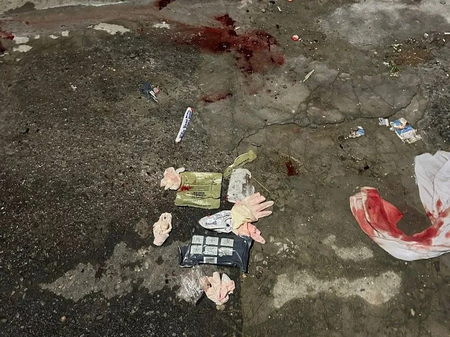 Materiais do atendimento de tentativa de feminicídio no bairro Cristal, em Porto Alegre Foto : Polícia Civil / CP