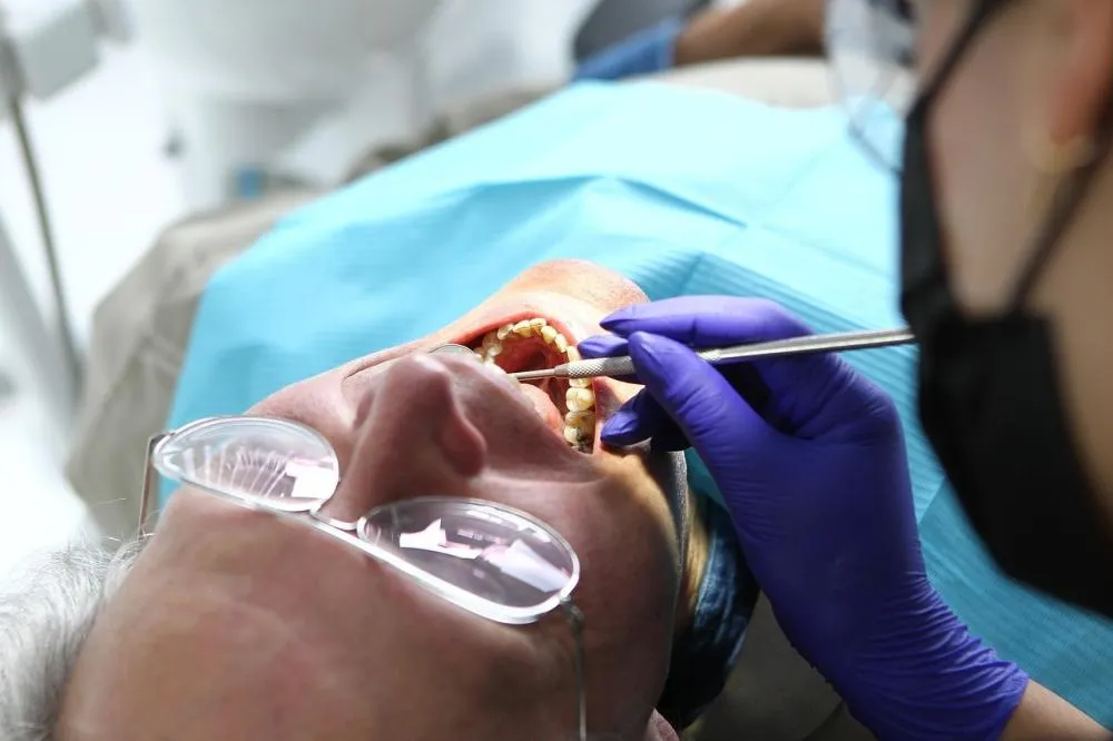 Benefícios do Implante Dentário em Porto Alegre