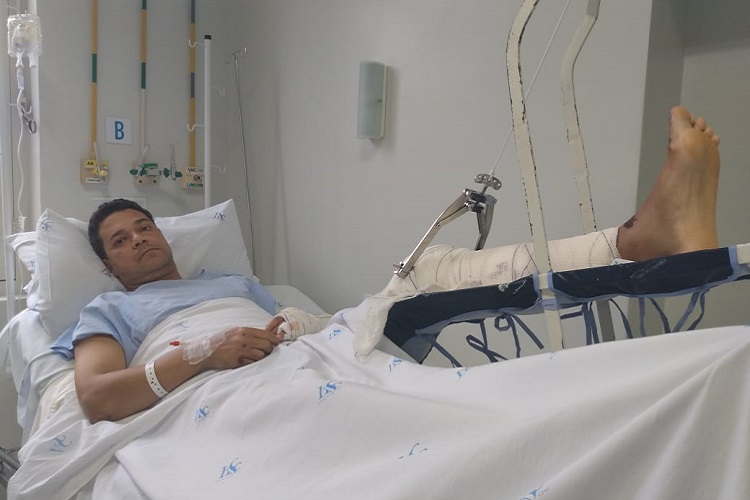 Vereador passou por cirurgia após o acidente