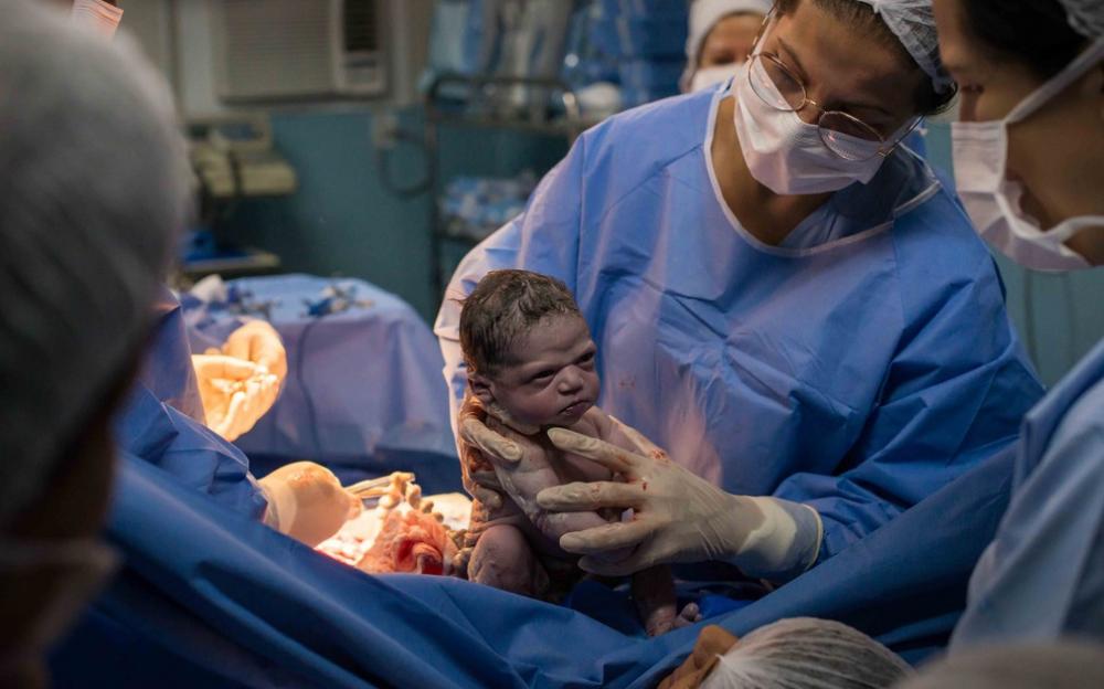 Foto de bebê no parto vira 'meme' nas redes sociais — Foto: Divulgação/Rodrigo Kunstmann