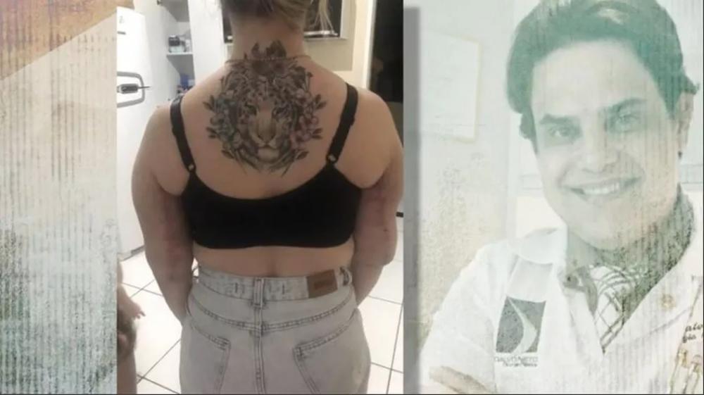Jeordana se submeteu ainda a uma cirurgia para a retirada de gordura dos braços: 'Eu não uso mais blusa de manga ou de alça' — Foto: Reprodução
