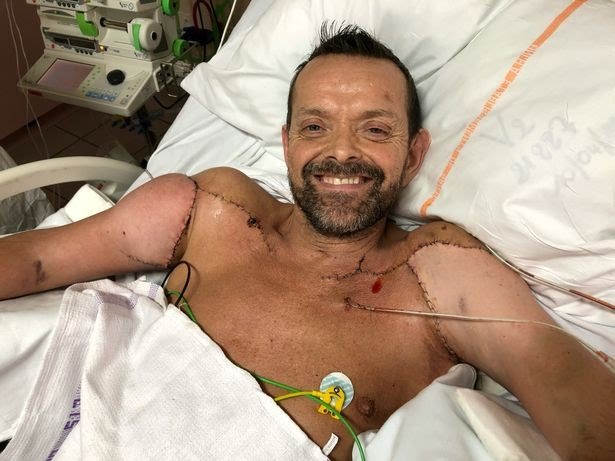 AVÔ, DA ISLÂNDIA, FAZ TRANSPLANTE DUPLO DE BRAÇOS (FOTO: REPRODUÇÃO/MIRROR)