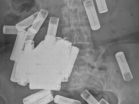 Imagem: Divulgação/Irish Medical Journal