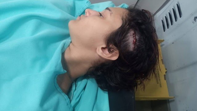 Estefane de Oliveira Laudano, de 19 anos, levou sete pontos na cabeça FOTO: REPRODUÇÃO